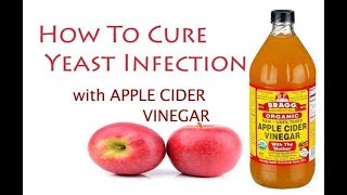 Apple Cider Vinegar for Yeast Infection Natural Treatment  yeast infection  home remedies [upl. by Zebulon]