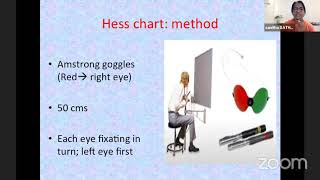 PG Orientation  Diplopia Charting  Dr Sanitha Sathyan [upl. by Mello]