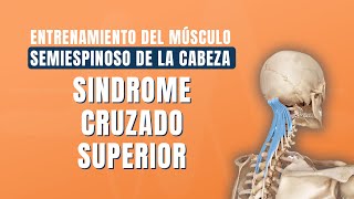 Entrenamiento del músculo semiespinoso de la cabeza en el síndrome cruzado superior [upl. by Alacim]