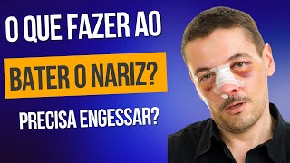 O que fazer ao bater o nariz Trauma nasal ou Nariz quebrado [upl. by Faxan518]