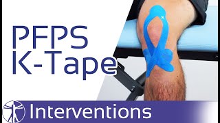 Kinesio Taping for PFPS  Patellofemoral Pain Syndrome [upl. by Kopp]