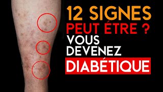 12 Signes Précoces Du Diabète Qui Doivent Vous Alerter [upl. by Alejandro]