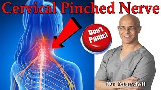 How to Overcome Cervical Pinched Nerve amp Radiculopathy Dont Panic  Dr Alan Mandell DC [upl. by Mahmoud]