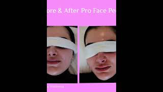 DERMALOGICA FACE PEEL [upl. by Ttevi]