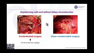 Postoperative Complication and Management [upl. by Selim]