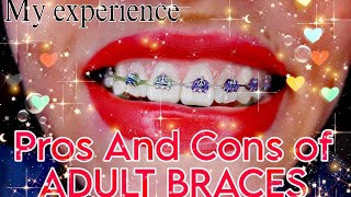 My Pros and Cons of braces And my experience having adult braces LolBorges [upl. by Collyer207]