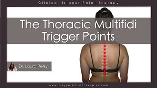 The Thoracic Multifidi Trigger Points [upl. by Breanne601]