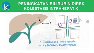 Patofisiologi Ikterus 2A2B  Peningkatan Bilirubin Direk Kolestasis Intrahepatik [upl. by Bettina]