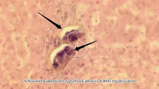 Schistosoma japonicum Egg in Tissue with Haematoxylin and Eosin HampE Stain [upl. by Vachill]