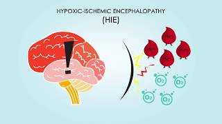 HypoxicIschemic Encephalopathy About Treatments amp Causes [upl. by Yssirk158]