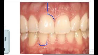 Introduction to dentistry  lecture 5 periodontics terminology [upl. by Firmin]