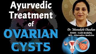 Ayurvedic Treatment of Ovarian Cysts  Dr Meenakshi Chauhan Chandigarh [upl. by Erastatus]