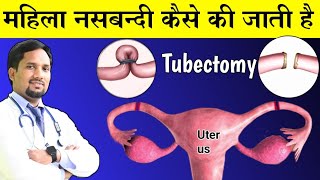 Mahila nasbandi kaise ki jati hai tubectomy  female sterilization healthvaani [upl. by Yrruc]