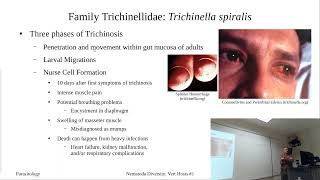 Trichinella spiralis [upl. by Migeon]