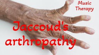 Jaccouds arthropathy  Music Therapy [upl. by Lenes]