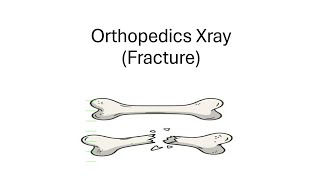 Orthopedics Xray।।Part1।।Fracture।।OSPE।।SOMC [upl. by Joli]