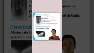 Osteíte Condensante  Características Clínicas e Radiográficas  Resumo Concurso Odontologia [upl. by Borrell716]