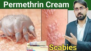 permethrin cream uses in hindi  scabies treatment in hindi  scabies permethrin cream Drx Rabbani [upl. by Marylin]