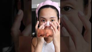 Quick Fix Korean Toner Pads Effect on Blackheads  MEDICUBE Zero Pore Pad 20 [upl. by Zohara]