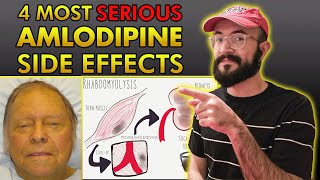 4 Most SERIOUS Amlodipine Side Effects [upl. by Killigrew464]