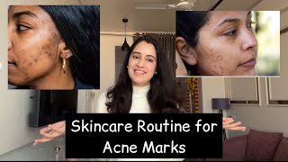 Skincare Routine for acne marks  Acne marks removal routine under rs 500  skincare  pimple marks [upl. by Zetrac]