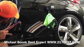 Paintless Dent Removal 2014 Hyundai Veloster body line dent and softball size edge dent Glue [upl. by Molahs]