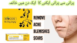 Biocos Acne Cream  Anti Acne Cream  Remove blemishes  Scars in First Application [upl. by Atirihs]