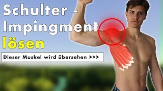 Schulterimpingement geht nicht weg  Dieser Muskel ist die Ursache  Übung [upl. by Twitt165]