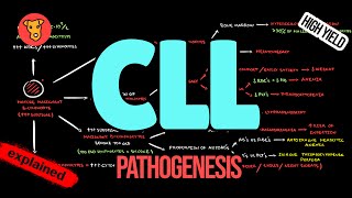 CHRONIC LYMPHOCYTIC LEUKEMIA Pathogenesis CLL Criteria Diagnosis Treatment [upl. by Mary]