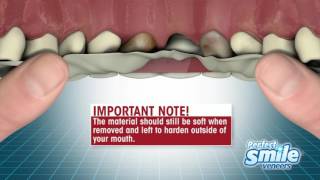 Perfect Smile Veneers Instructional  Getting Started [upl. by Claire]