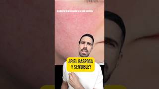 PIEL SENSIBLE tienes DEMODEX Aprende a eliminar este ácaro de tu cara [upl. by Brandea]