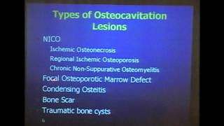 Diagnosis and Treatment of Cavitational Osteonecrosis [upl. by Anitsihc904]