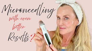 Better Results from Microneedling  New Bio Pen Q2 first impression amp full demo [upl. by Barcroft]