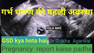 Gestational sac GShow to read pregnancy report yolk sac doctor home [upl. by Auqined]