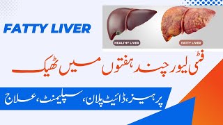 Reverse Fatty Liver within weeks  چند ہفتوں میں سوزش جگر ٹھیک [upl. by Akinej167]