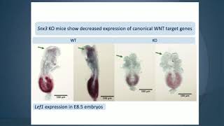 Phenotyping Embryonic Lethal Knockout mice with neural crest and neural defects  Lee Niswander [upl. by Primaveria]