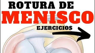 🏋🏻‍♀️ 8 Ejercicios ROTURA de MENISCO [upl. by Erised]