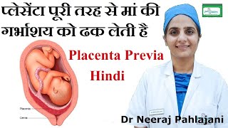 Placenta Previa होने के लक्षण इलाज और Low Lying Placenta से कैसे बचे [upl. by Maxfield949]