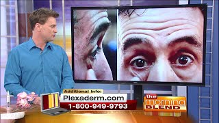 How To Get Rid Of Wrinkles Eye Bags and Crows Feet with Plexaderm [upl. by Yliah845]