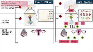 Gonadotropinreleasing hormone GnRH agonists [upl. by Kalina]