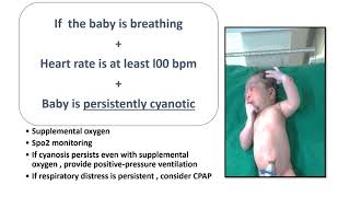 Neonatal Resuscitation Part3  2020 AAP Guidelines  Positive Pressure Ventilation StepB [upl. by Udelle]