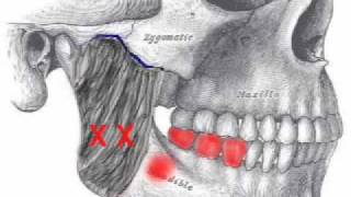 Masseter Muscle Assessment [upl. by Anaylil43]