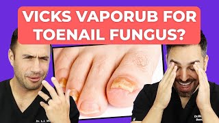 Ointment To CURE Toenail Fungus  Doctorly Investigates [upl. by Alraep751]