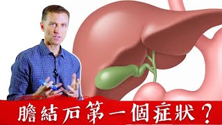 膽結石的第一症狀？80膽結石的人自然療法柏格醫生 Dr Berg [upl. by Hynes]