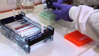 How to run an agarose gel [upl. by Idola349]