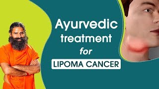 Ayurvedic Treatment for Lipoma Cancer  Swami Ramdev [upl. by Aicilak]