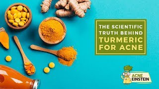 How to use turmeric for acne [upl. by Rubetta]