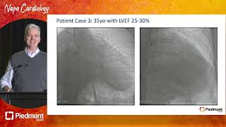 Appraisal of Successes and Shortfalls in CTO Revascularization [upl. by Nooj]