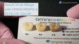 Example of use OMNICHROMA by TOKUYAMA DENTAL [upl. by Aikimat]