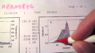 chernobyl 2012 albedo personal dosimeter dose report vs brazil holiday radiation [upl. by Ojytteb]